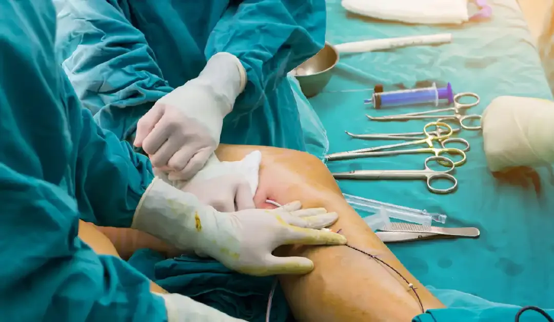 Surgical precision by Dr. Ankur Saurav