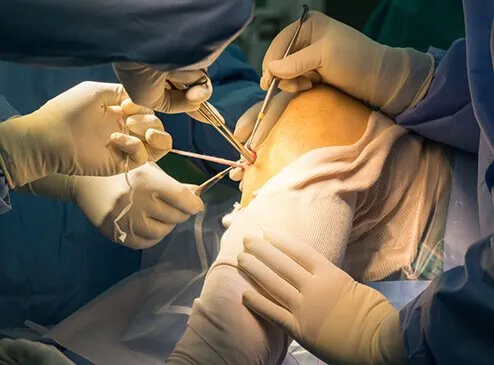 Orthopedic surgery at Medifirst Hospital, Ranchi